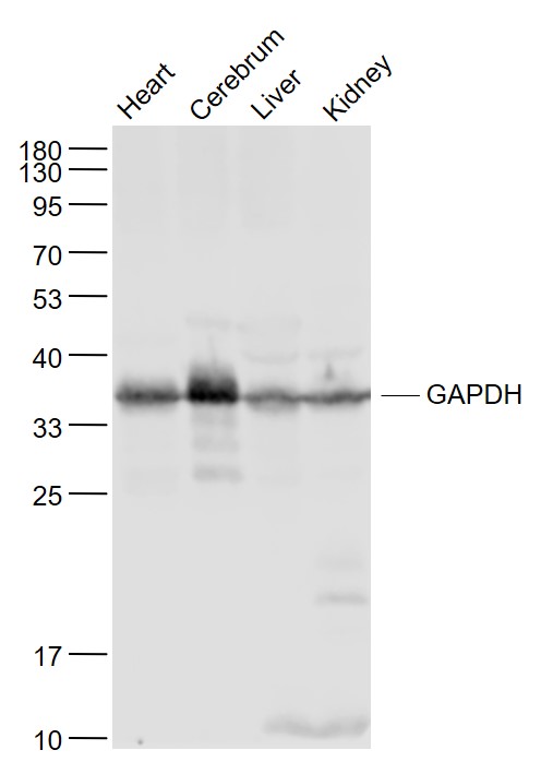 Lane 1: Mouse Heart lysates; Lane 2: Mouse Cerebrum lysates; Lane 3: Mouse Liver lysates; Lane 4: Mouse Kindey lysates probed with GAPDH Polyclonal Antibody, Unconjugated (bs-10900R) at 1:1000 dilution and 4˚C overnight incubation. Followed by conjugated secondary antibody incubation at 1:20000 for 60 min at 37˚C.