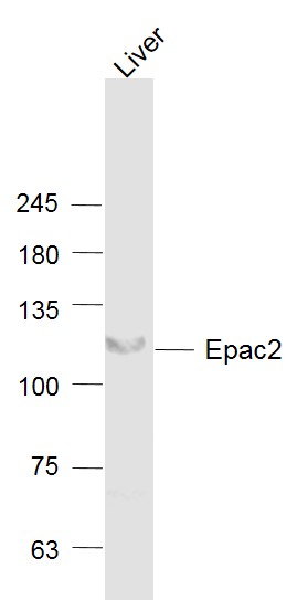 Lane 1: Liver lysates probed with Epac2 Polyclonal Antibody, Unconjugated (bs-10955R) at 1:1000 dilution and 4˚C overnight incubation. Followed by conjugated secondary antibody incubation at 1:20000 for 60 min at 37˚C.