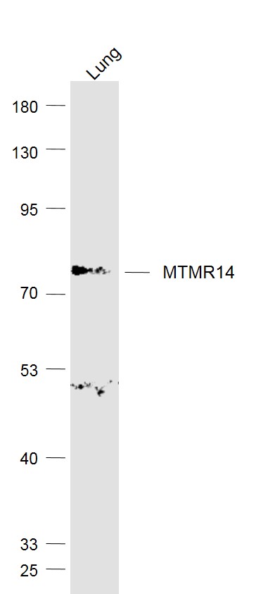 Lane 1: Lung lysates probed with MTMR14 Polyclonal Antibody, Unconjugated (bs-11217R) at 1:1000 dilution and 4˚C overnight incubation. Followed by conjugated secondary antibody incubation at 1:20000 for 60 min at 37˚C.