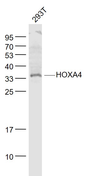 Lane 1: 293T cell lysates probed with HOXA4 Polyclonal Antibody, Unconjugated (bs-11293R) at 1:1000 dilution and 4˚C overnight incubation. Followed by conjugated secondary antibody incubation at 1:20000 for 60 min at 37˚C.