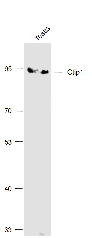 Lane 1: Testis lysates probed with Ctip1/BCL-11A Polyclonal Antibody, Unconjugated (bs-11544R) at 1:1000 dilution and 4˚C overnight incubation. Followed by conjugated secondary antibody incubation at 1:20000 for 60 min at 37˚C.