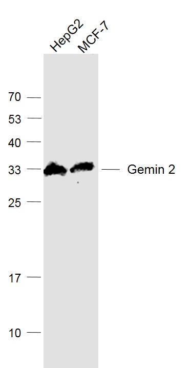 Lane 1: HepG2 cell lysates; Lane 2: MCF-7 cell lysates probed with Gemin 2/SMA Polyclonal Antibody, Unconjugated (bs-11562R) at 1:1000 dilution and 4˚C overnight incubation. Followed by conjugated secondary antibody incubation at 1:20000 for 60 min at 37˚C.