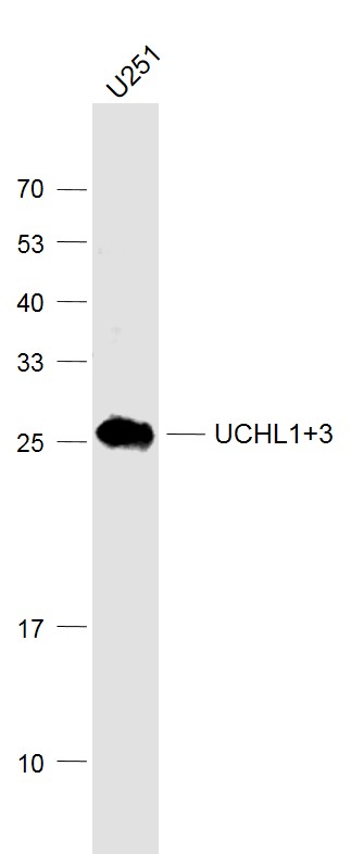Lane 1: U251 cell lysates probed with UCHL1+3 Polyclonal Antibody, Unconjugated (bs-11677R) at 1:1000 dilution and 4˚C overnight incubation. Followed by conjugated secondary antibody incubation at 1:20000 for 60 min at 37˚C.