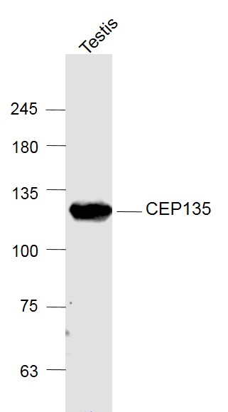 Lane 1: Testis lysates probed with CEP135 Polyclonal Antibody, Unconjugated (bs-12282R) at 1:1000 dilution and 4˚C overnight incubation. Followed by conjugated secondary antibody incubation at 1:20000 for 60 min at 37˚C.