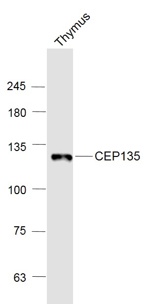 Lane 1: Thymus lysates probed with CEP135 Polyclonal Antibody, Unconjugated (bs-12282R) at 1:1000 dilution and 4˚C overnight incubation. Followed by conjugated secondary antibody incubation at 1:20000 for 60 min at 37˚C.