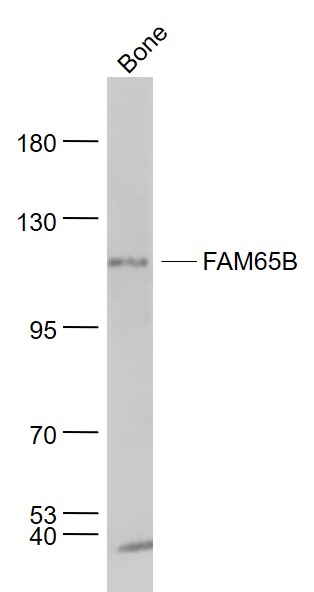 Lane 1: Bone lysates probed with FAM65B Polyclonal Antibody, Unconjugated (bs-12370R) at 1:1000 dilution and 4˚C overnight incubation. Followed by conjugated secondary antibody incubation at 1:20000 for 60 min at 37˚C.