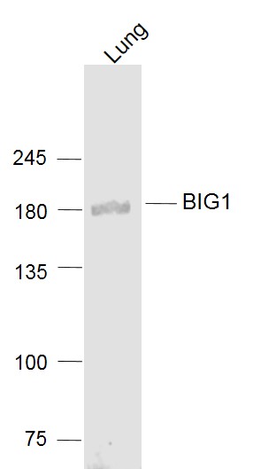 Lane 1: Lung lysates probed with BIG1/ARFGEF1 Polyclonal Antibody, Unconjugated (bs-12866R) at 1:1000 dilution and 4˚C overnight incubation. Followed by conjugated secondary antibody incubation at 1:20000 for 60 min at 37˚C.
