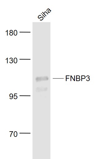 Lane 1: Siha cell lysates probed with FNBP3 Polyclonal Antibody, Unconjugated (bs-13190R) at 1:1000 dilution and 4˚C overnight incubation. Followed by conjugated secondary antibody incubation at 1:20000 for 60 min at 37˚C.