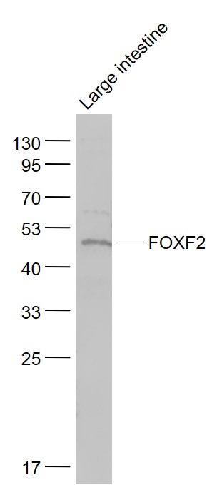 Lane 1: Large intestine lysates probed with FOXF2 Polyclonal Antibody, Unconjugated (bs-13201R) at 1:1000 dilution and 4˚C overnight incubation. Followed by conjugated secondary antibody incubation at 1:20000 for 60 min at 37˚C.