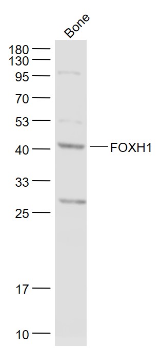 Lane 1: Bone lysates probed with FOXH1 Polyclonal Antibody, Unconjugated (bs-13202R) at 1:1000 dilution and 4˚C overnight incubation. Followed by conjugated secondary antibody incubation at 1:20000 for 60 min at 37˚C.
