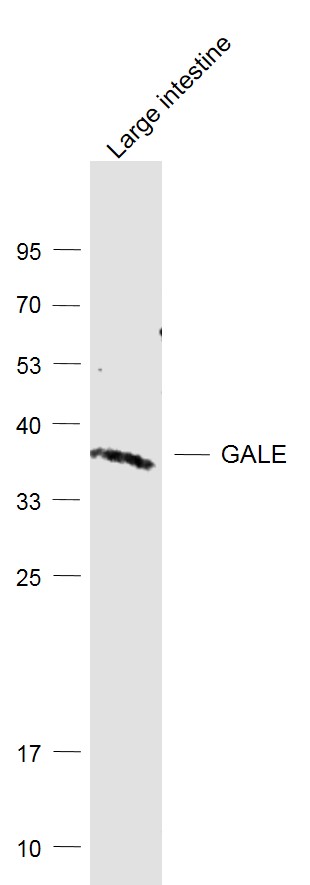 Large intestine lysates probed with GALE/Galactowaldenase Polyclonal Antibody, Unconjugated (bs-13265R) at 1:1000 dilution and 4˚C overnight incubation. Followed by conjugated secondary antibody incubation at 1:20000 for 60 min at 37˚C. Large intestine lysates probed with GALE/Galactowaldenase Polyclonal Antibody, Unconjugated (bs-13265R) at 1:1000 dilution and 4˚C overnight incubation. Followed by conjugated secondary antibody incubation at 1:20000 for 60 min at 37˚C.