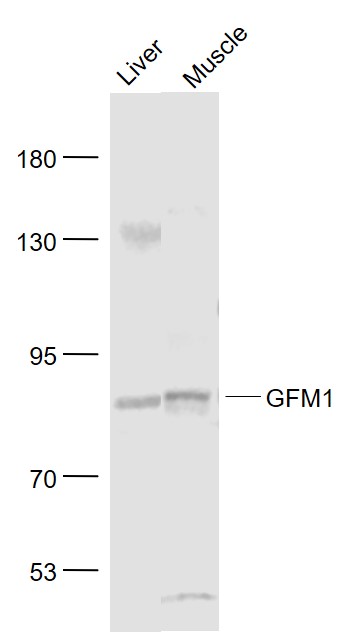 Lane 1: Mouse Liver lysates; Lane 2: Mouse muscle lysates probed with GFM1 Polyclonal Antibody, Unconjugated (bs-13338R) at 1:1000 dilution and 4˚C overnight incubation. Followed by conjugated secondary antibody incubation at 1:20000 for 60 min at 37˚C.