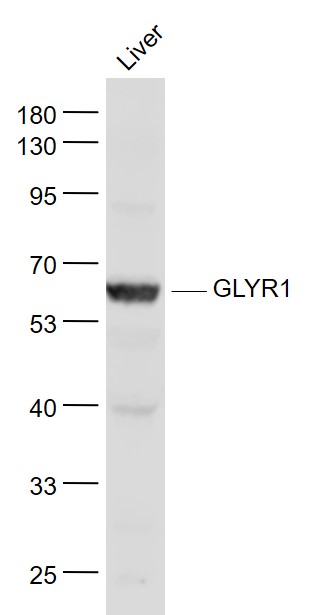 Lane 1: Liver lysates probed with GLYR1/NP60 Polyclonal Antibody, Unconjugated (bs-13451R) at 1:1000 dilution and 4˚C overnight incubation. Followed by conjugated secondary antibody incubation at 1:20000 for 60 min at 37˚C.