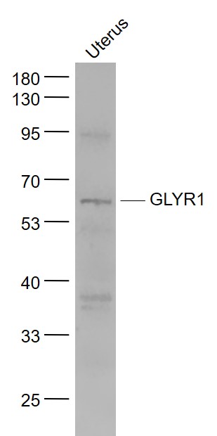 Lane 1: Uterus lysates probed with GLYR1/NP60 Polyclonal Antibody, Unconjugated (bs-13451R) at 1:1000 dilution and 4˚C overnight incubation. Followed by conjugated secondary antibody incubation at 1:20000 for 60 min at 37˚C.