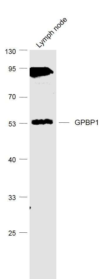 Lane 1: Lymph node lysates probed with GPBP1/Vasculin Polyclonal Antibody, Unconjugated (bs-13503R) at 1:1000 dilution and 4˚C overnight incubation. Followed by conjugated secondary antibody incubation at 1:20000 for 60 min at 37˚C.