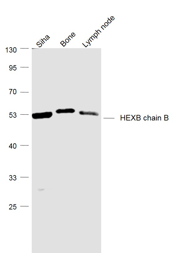 Lane 1: Siha cell lysates; Lane 2: Mouse Bone lysates; Lane 3: Mouse Lymph node lysates probed with HEXB chain B Polyclonal Antibody, Unconjugated (bs-15468R) at 1:1000 dilution and 4˚C overnight incubation. Followed by conjugated secondary antibody incubation at 1:20000 for 60 min at 37˚C.