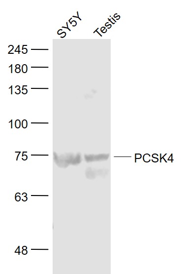 Lane 1: SY5Y cell lysates; Lane 2: Mouse Testis lysates probed with PCSK4 Polyclonal Antibody, Unconjugated (bs-15501R) at 1:1000 dilution and 4˚C overnight incubation. Followed by conjugated secondary antibody incubation at 1:20000 for 60 min at 37˚C.