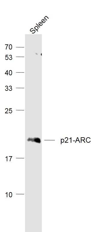 Lane 1: Spleen lysates probed with p21-ARC Polyclonal Antibody, Unconjugated (bs-17589R) at 1:1000 dilution and 4˚C overnight incubation. Followed by conjugated secondary antibody incubation at 1:20000 for 60 min at 37˚C.