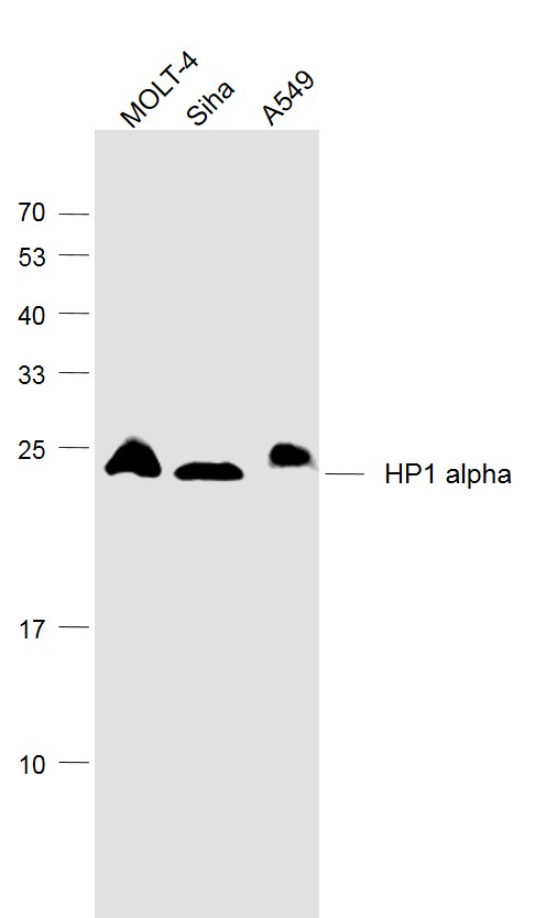 Lane 1: Molt-4 cell lysates; Lane 2: Siha cell lysates; Lane 3: A549 cell lysates probed with HP1 alpha Monoclonal Antibody, Unconjugated (bsm-33377M) at 1:1000 dilution and 4˚C overnight incubation. Followed by conjugated secondary antibody incubation at 1:20000 for 60 min at 37˚C.