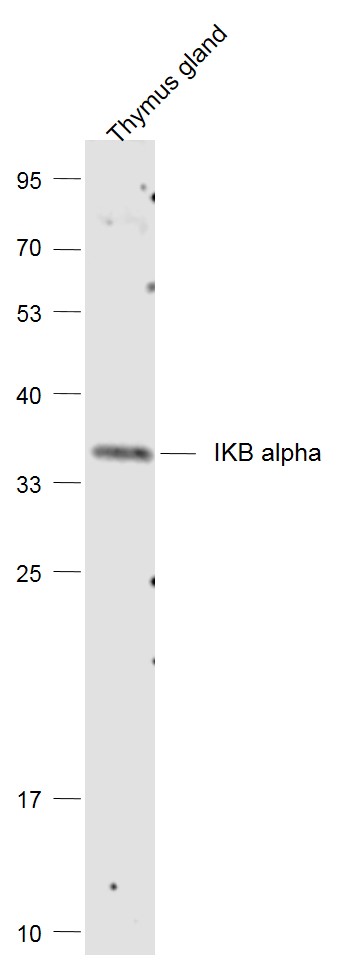 Lane 1: Thymus lysates probed with NFKBIA\/IKB alpha Polyclonal Antibody, Unconjugated (bs-1287R) at 1:1000 dilution and 4˚C overnight incubation. Followed by conjugated secondary antibody incubation at 1:20000 for 60 min at 37˚C.