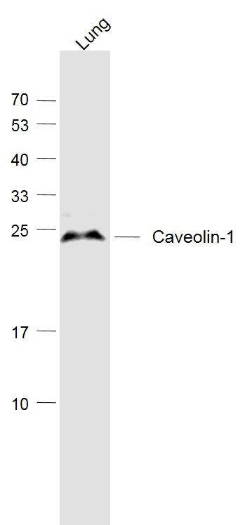 Lane 1: Lung lysates probed with Caveolin-1 Polyclonal Antibody, Unconjugated (bs-1453R) at 1:1000 dilution and 4˚C overnight incubation. Followed by conjugated secondary antibody incubation at 1:20000 for 60 min at 37˚C.