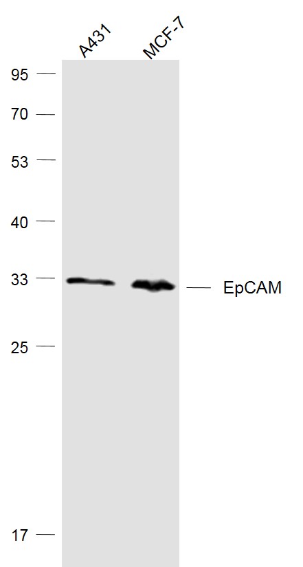 Lane 1: A431 cell lysates; Lane 2: MCF-7 cell lysates probed with SIRT4 Polyclonal Antibody, Unconjugated (bs-1513R) at 1:1000 dilution and 4˚C overnight incubation. Followed by conjugated secondary antibody incubation at 1:20000 for 60 min at 37˚C.