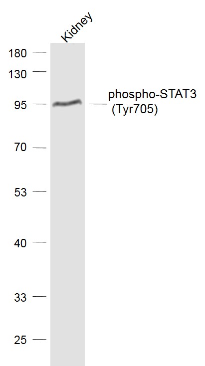 Lane 1: Kindey lysates probed with STAT3 (Tyr705) Polyclonal Antibody, Unconjugated (bs-1658R) at 1:1000 dilution and 4˚C overnight incubation. Followed by conjugated secondary antibody incubation at 1:20000 for 60 min at 37˚C.