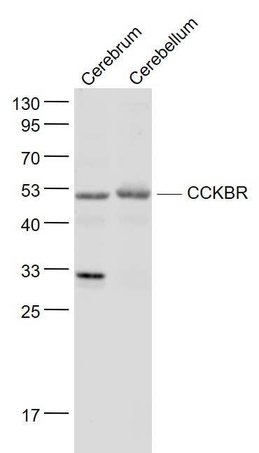 Lane 1: Mouse Cerebrum lysates; Lane 2: Mouse Cerebellum lysates probed with Gastrin receptor\/CCKBR Polyclonal Antibody, Unconjugated (bs-1777R) at 1:1000 dilution and 4˚C overnight incubation. Followed by conjugated secondary antibody incubation at 1:20000 for 60 min at 37˚C.