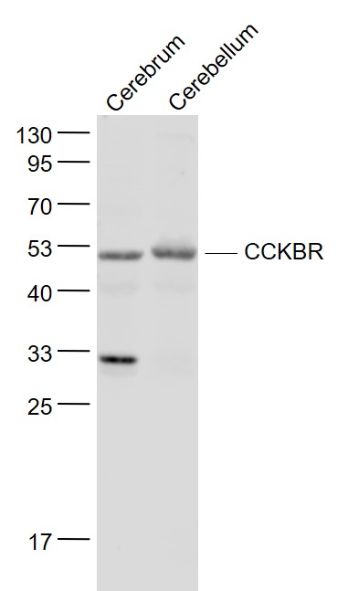 Lane 1: Mouse Cerebrum lysates; Lane 2: Mouse Cerebellum lysates probed with Gastrin receptor/CCKBR Polyclonal Antibody, Unconjugated (bs-1777R) at 1:1000 dilution and 4˚C overnight incubation. Followed by conjugated secondary antibody incubation at 1:20000 for 60 min at 37˚C.
