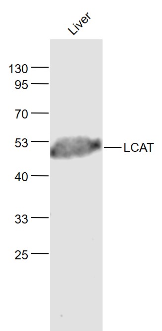 Lane 1: Liver lysates probed with LCAT Polyclonal Antibody, Unconjugated (bs-1972R) at 1:1000 dilution and 4˚C overnight incubation. Followed by conjugated secondary antibody incubation at 1:20000 for 60 min at 37˚C.