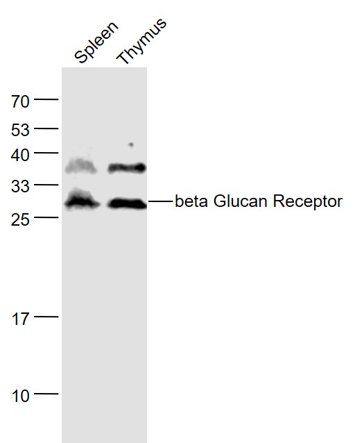 Lane 1: Mouse Spleen lysates; Lane 2: Mouse Thymus lysates probed with Beta Glucan Receptor Polyclonal Antibody, Unconjugated (bs-2455R) at 1:1000 dilution and 4˚C overnight incubation. Followed by conjugated secondary antibody incubation at 1:20000 for 60 min at 37˚C.