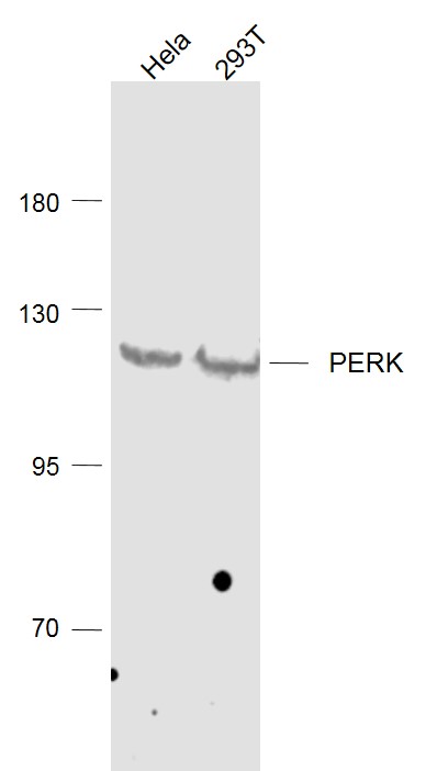 Lane 1: Hela cell lysates; Lane 2: 293T cell lysates probed with PERK Polyclonal Antibody, Unconjugated (bs-2469R) at 1:1000 dilution and 4˚C overnight incubation. Followed by conjugated secondary antibody incubation at 1:20000 for 60 min at 37˚C.