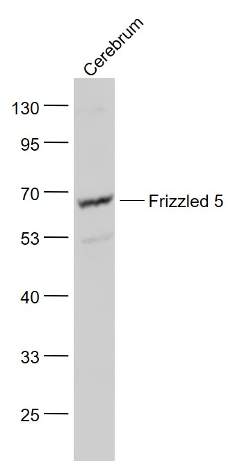 Lane 1: Cerebrum lysates probed with Frizzled 5/8 Polyclonal Antibody, Unconjugated (bs-2930R) at 1:1000 dilution and 4˚C overnight incubation. Followed by conjugated secondary antibody incubation at 1:20000 for 60 min at 37˚C.