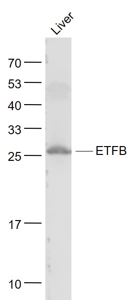 Lane 1: Liver lysates probed with ETFB Polyclonal Antibody, Unconjugated (bs-3937R) at 1:1000 dilution and 4˚C overnight incubation. Followed by conjugated secondary antibody incubation at 1:20000 for 60 min at 37˚C.