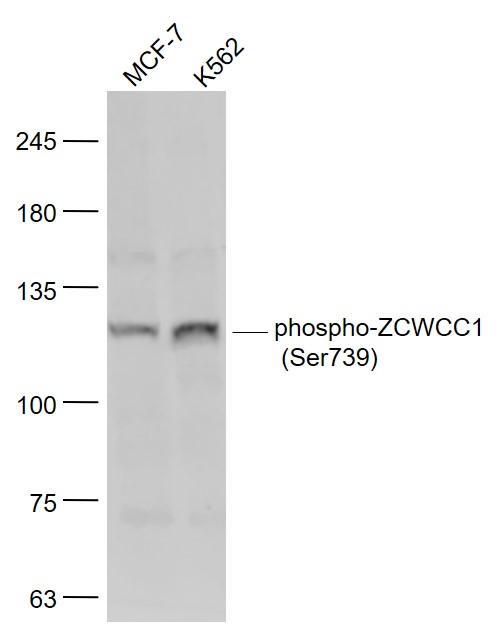 Lane 1: MCF-7 cell lysates; Lane 2: K562 cell lysates probed with ZCWCC1 (Ser739) Polyclonal Antibody, Unconjugated (bs-10016R) at 1:1000 dilution and 4˚C overnight incubation. Followed by conjugated secondary antibody incubation at 1:20000 for 60 min at 37˚C.