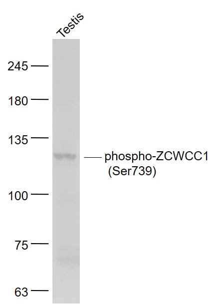 Mouse testis lysates probed with ZCWCC1 (Ser739) Polyclonal Antibody, Unconjugated (bs-10016R) at 1:1000 dilution and 4˚C overnight incubation. Followed by conjugated secondary antibody incubation at 1:20000 for 60 min at 37˚C.