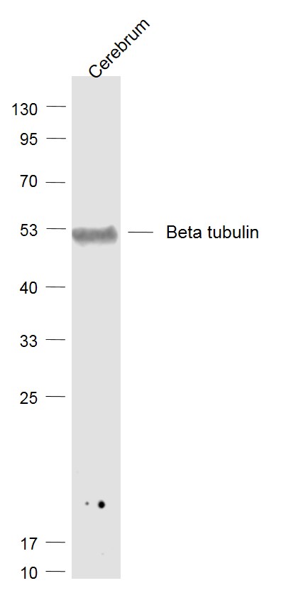 Lane 1: Cerebrum lysates probed with tubulin Beta Polyclonal Antibody, Unconjugated (bs-4511R) at 1:1000 dilution and 4˚C overnight incubation. Followed by conjugated secondary antibody incubation at 1:20000 for 60 min at 37˚C.