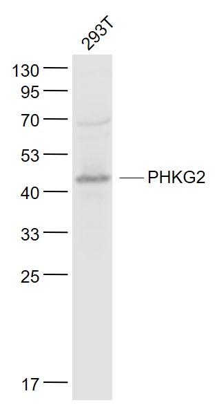 Lane 1: 293T cell lysates probed with PHKG2 Polyclonal Antibody, Unconjugated (bs-5010R) at 1:1000 dilution and 4˚C overnight incubation. Followed by conjugated secondary antibody incubation at 1:20000 for 60 min at 37˚C.