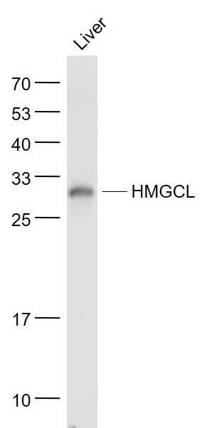 Lane 1: Liver lysates probed with HMGCL Polyclonal Antibody, Unconjugated (bs-5067R) at 1:1000 dilution and 4˚C overnight incubation. Followed by conjugated secondary antibody incubation at 1:20000 for 60 min at 37˚C.