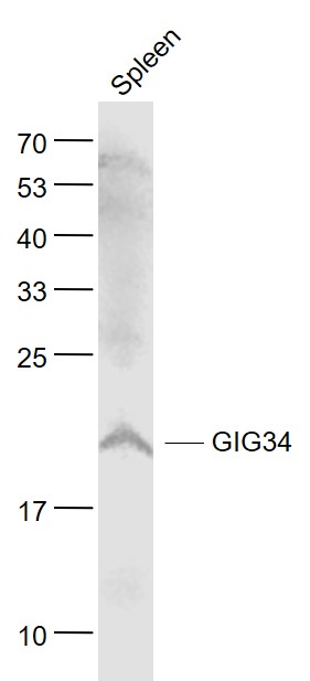 Lane 1: Spleen lysates probed with RPL11 Polyclonal Antibody, Unconjugated (bs-5715R) at 1:1000 dilution and 4˚C overnight incubation. Followed by conjugated secondary antibody incubation at 1:20000 for 60 min at 37˚C.