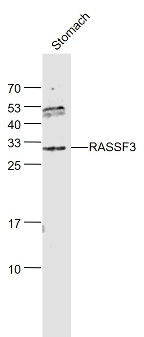 Lane 1: Stomach lysates probed with RASSF3 Polyclonal Antibody, Unconjugated (bs-6078R) at 1:1000 dilution and 4˚C overnight incubation. Followed by conjugated secondary antibody incubation at 1:20000 for 60 min at 37˚C.