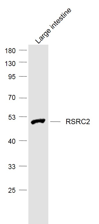 Lane 1: Large intestine lysates probed with RSRC2 Polyclonal Antibody, Unconjugated (bs-6097R) at 1:1000 dilution and 4˚C overnight incubation. Followed by conjugated secondary antibody incubation at 1:20000 for 60 min at 37˚C.