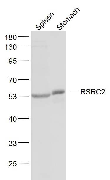 Lane 1: Mouse Spleen lysates; Lane 2: Mouse Stomach lysates probed with RSRC2 Polyclonal Antibody, Unconjugated (bs-6097R) at 1:1000 dilution and 4˚C overnight incubation. Followed by conjugated secondary antibody incubation at 1:20000 for 60 min at 37˚C.