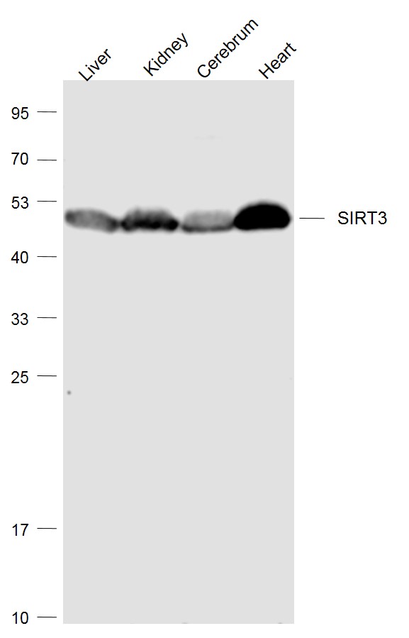 Lane 1: Mouse Liver lysates; Lane 2: Mouse Kindey lysates; Lane 3: Mouse Cerebrum lysates; Lane 4: MouseHeart lysates probed with SIRT3 Polyclonal Antibody, Unconjugated (bs-6105R) at 1:1000 dilution and 4˚C overnight incubation. Followed by conjugated secondary antibody incubation at 1:20000 for 60 min at 37˚C.