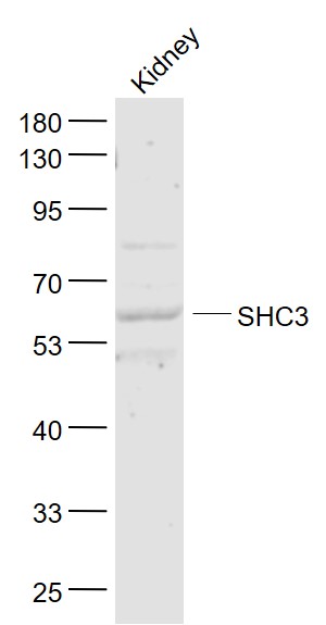 Lane 1: Kindey lysates probed with SHC3 Polyclonal Antibody, Unconjugated (bs-6199R) at 1:1000 dilution and 4˚C overnight incubation. Followed by conjugated secondary antibody incubation at 1:20000 for 60 min at 37˚C.