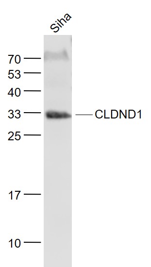 Lane 1: Kindey lysates probed with CLDND1 Polyclonal Antibody, Unconjugated (bs-6683R) at 1:1000 dilution and 4˚C overnight incubation. Followed by conjugated secondary antibody incubation at 1:20000 for 60 min at 37˚C.