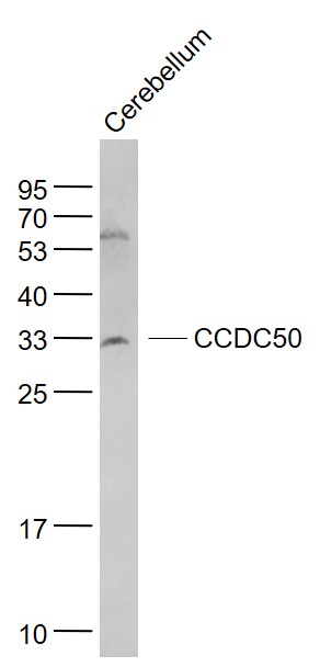 Lane 1: Cerebellum lysates probed with CCDC50 Polyclonal Antibody, Unconjugated (bs-6920R) at 1:1000 dilution and 4˚C overnight incubation. Followed by conjugated secondary antibody incubation at 1:20000 for 60 min at 37˚C.
