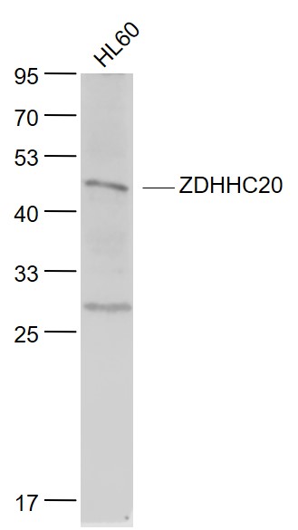 Lane 1: HL60 cell lysates probed with DHHC-20 Polyclonal Antibody, Unconjugated (bs-7418R) at 1:1000 dilution and 4˚C overnight incubation. Followed by conjugated secondary antibody incubation at 1:20000 for 60 min at 37˚C. Lane 1: HL60 cell lysates probed with DHHC-20 Polyclonal Antibody, Unconjugated (bs-7418R) at 1:1000 dilution and 4˚C overnight incubation. Followed by conjugated secondary antibody incubation at 1:20000 for 60 min at 37˚C.