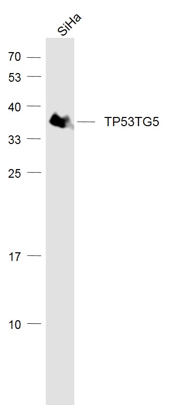 Lane 1: Siha cell lysates probed with TP53TG5 Polyclonal Antibody, Unconjugated (bs-7702R) at 1:1000 dilution and 4˚C overnight incubation. Followed by conjugated secondary antibody incubation at 1:20000 for 60 min at 37˚C.