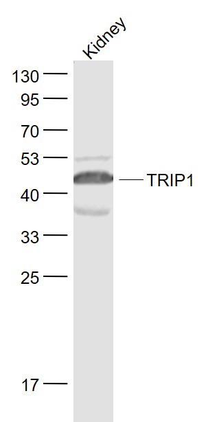 Lane 1: Kindey lysates probed with TRIP1 Polyclonal Antibody, Unconjugated (bs-7731R) at 1:1000 dilution and 4˚C overnight incubation. Followed by conjugated secondary antibody incubation at 1:20000 for 60 min at 37˚C.